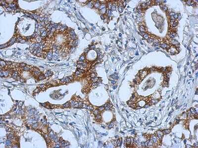 Immunohistochemistry-Paraffin: SPG8 Antibody [NBP2-20471]