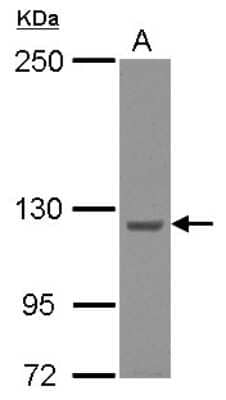 Western Blot: SPG8 Antibody [NBP2-20471]