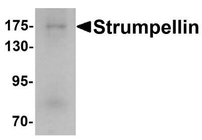 Western Blot: SPG8 AntibodyBSA Free [NBP2-82036]