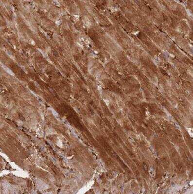 Immunohistochemistry: SPHKAP Antibody [NBP2-30973]