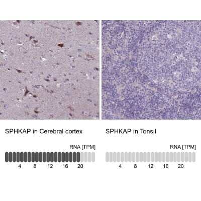 Immunohistochemistry-Paraffin: SPHKAP Antibody [NBP2-30770]