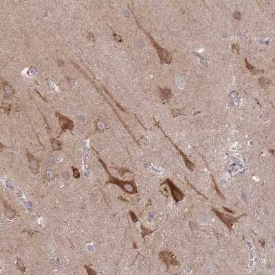 Immunohistochemistry-Paraffin: SPHKAP Antibody [NBP2-30973]