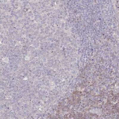 Immunohistochemistry-Paraffin: SPHKAP Antibody [NBP2-30973]