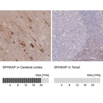 Immunohistochemistry-Paraffin: SPHKAP Antibody [NBP2-30973]