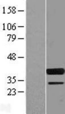 Western Blot: Spi-B Overexpression Lysate [NBL1-16399]