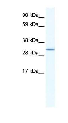 Western Blot: SPIC Antibody [NBP1-80288]