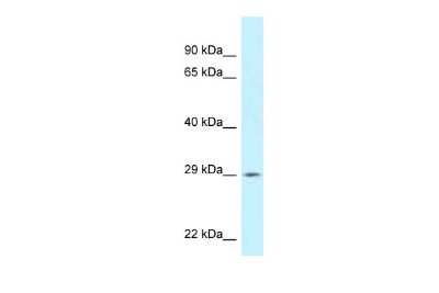 Western Blot: SPIC Antibody [NBP2-84277]