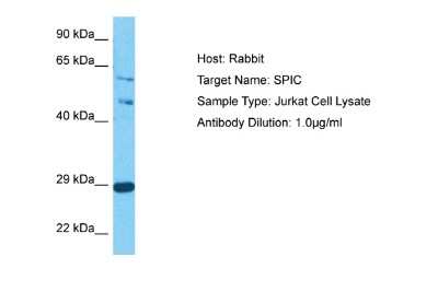 Western Blot: SPIC Antibody [NBP2-84277]