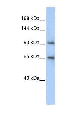 Western Blot: SPICE1 Antibody [NBP1-70712]