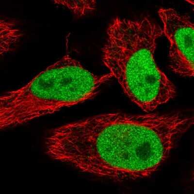 Immunocytochemistry/ Immunofluorescence: SPIN1 Antibody [NBP2-55843]