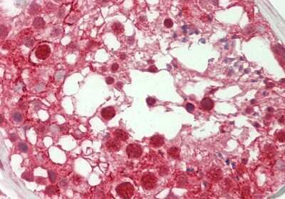 Immunohistochemistry-Paraffin: SPIN1 Antibody [NBP2-83590]