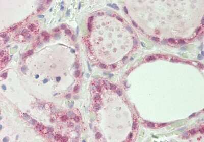 Immunohistochemistry-Paraffin: SPIN1 Antibody [NBP2-83590]