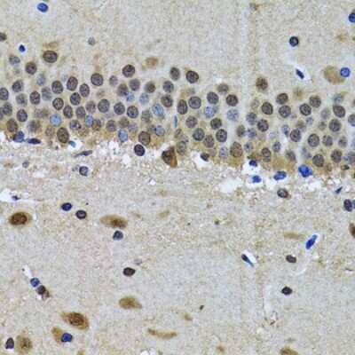 Immunohistochemistry-Paraffin: SPIN1 Antibody - BSA Free [NBP2-94461]