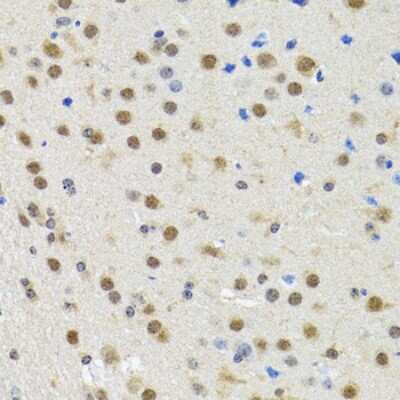 Immunohistochemistry-Paraffin: SPIN1 Antibody - BSA Free [NBP2-94461]