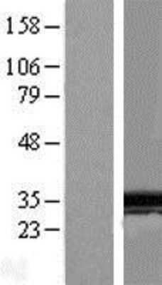 Western Blot: SPIN1 Overexpression Lysate [NBL1-16401]