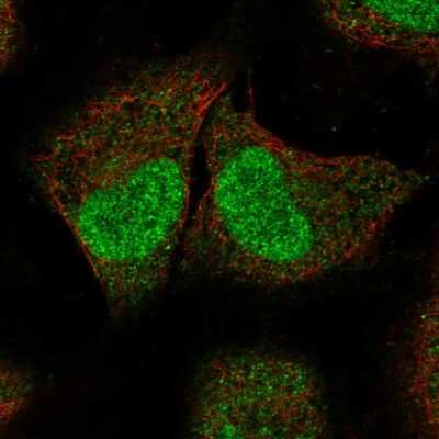 Immunocytochemistry/ Immunofluorescence: SPIN2A Antibody [NBP2-55824]