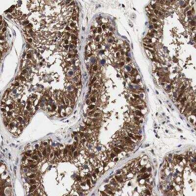 Immunohistochemistry-Paraffin: SPIN2B Antibody [NBP1-80728]