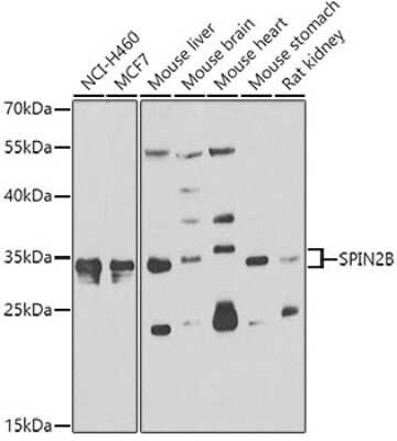 Western Blot: SPIN2B AntibodyBSA Free [NBP2-93087]