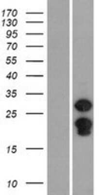 Western Blot: SPIN2B Overexpression Lysate [NBL1-16403]