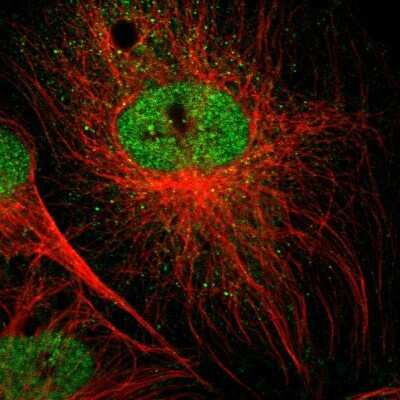 Immunocytochemistry/ Immunofluorescence: SPIN3 Antibody [NBP1-91204]