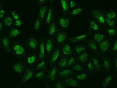 Immunocytochemistry/ Immunofluorescence: SPIN4 Antibody [NBP2-97667]