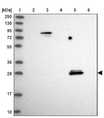 Western Blot: SPIN4 Antibody [NBP1-93750]