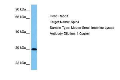 Western Blot: SPIN4 Antibody [NBP2-83593]