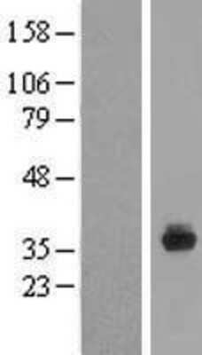 Western Blot: SPIN4 Overexpression Lysate [NBP2-08691]