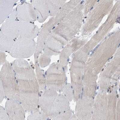 Immunohistochemistry-Paraffin: SPINDOC Antibody [NBP1-81298]