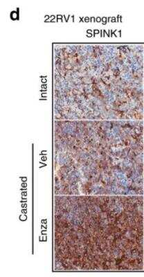 Immunohistochemistry: SPINK1 Antibody (4D4) [H00006690-M01]