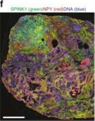 Immunohistochemistry: SPINK1 Antibody (4D4) [H00006690-M01]