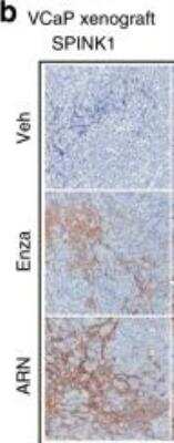 Immunohistochemistry: SPINK1 Antibody (4D4) [H00006690-M01]