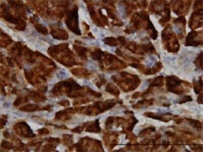 Immunohistochemistry-Paraffin: SPINK1 Antibody (4D4) [H00006690-M01]