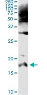 Immunoprecipitation: SPINK1 Antibody (4D4) [H00006690-M01]
