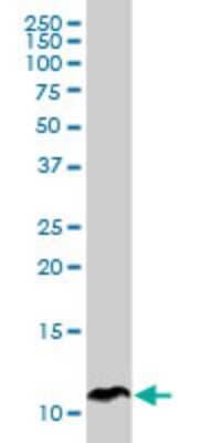 Western Blot: SPINK1 Antibody (4D4) [H00006690-M01]