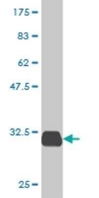 Western Blot: SPINK1 Antibody (4D4) [H00006690-M01]