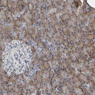 Immunohistochemistry: SPINK1 Antibody [NBP1-87314]