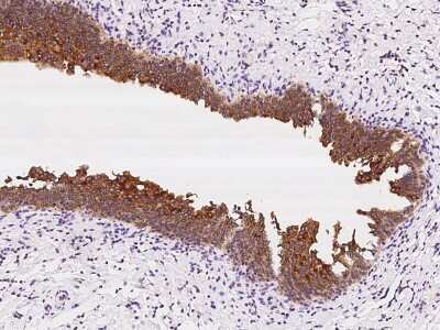 Immunohistochemistry-Paraffin: SPINK1 Antibody [NBP2-98602]