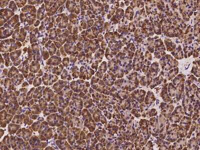 Immunohistochemistry-Paraffin: SPINK1 Antibody [NBP2-98602]