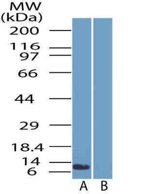 Western Blot: SPINK1 AntibodyBSA Free [NBP2-29620]