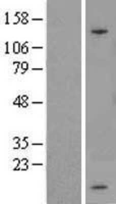 Western Blot: SPINK1 Overexpression Lysate [NBL1-16405]