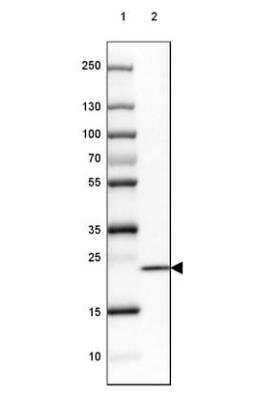 Western Blot: SPINK13 Antibody [NBP1-93701]