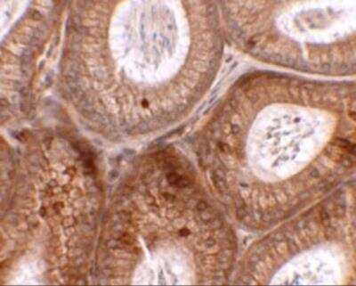 Immunohistochemistry: SPINK2 Antibody - BSA Free [NBP2-82015]