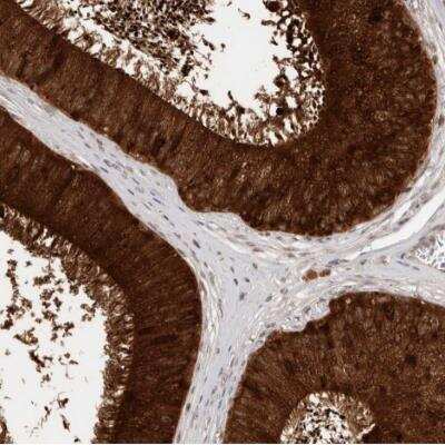 Immunohistochemistry-Paraffin: SPINK2 Antibody [NBP1-83133]