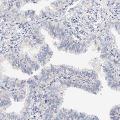 Immunohistochemistry-Paraffin: SPINK2 Antibody [NBP1-83133]