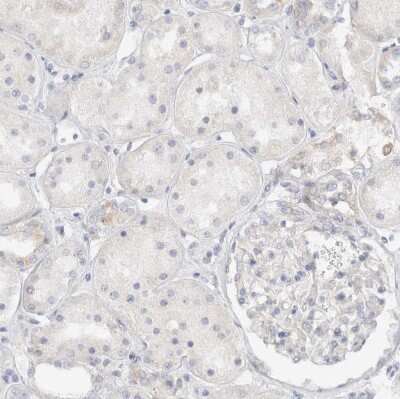 Immunohistochemistry-Paraffin: SPINK2 Antibody [NBP1-83133]