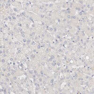 Immunohistochemistry-Paraffin: SPINK2 Antibody [NBP1-83133]