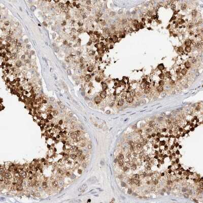 Immunohistochemistry-Paraffin: SPINK2 Antibody [NBP1-83133]