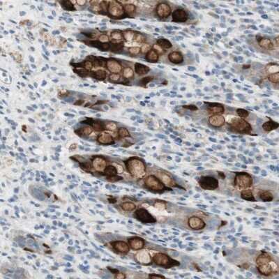 Immunohistochemistry-Paraffin: SPINK4 Antibody [NBP1-93519]