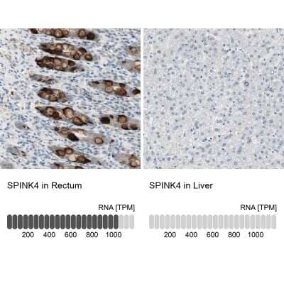 Immunohistochemistry-Paraffin: SPINK4 Antibody [NBP1-93519]